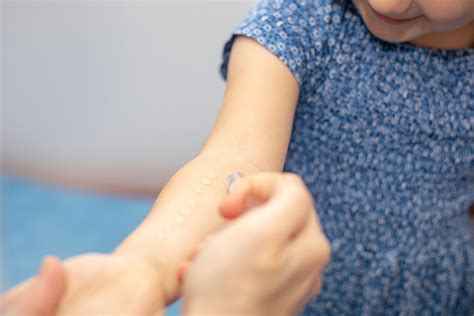 scratch test allergy toddler|allergy testing for kids.